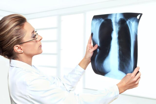 Doctor Holding Xrays
